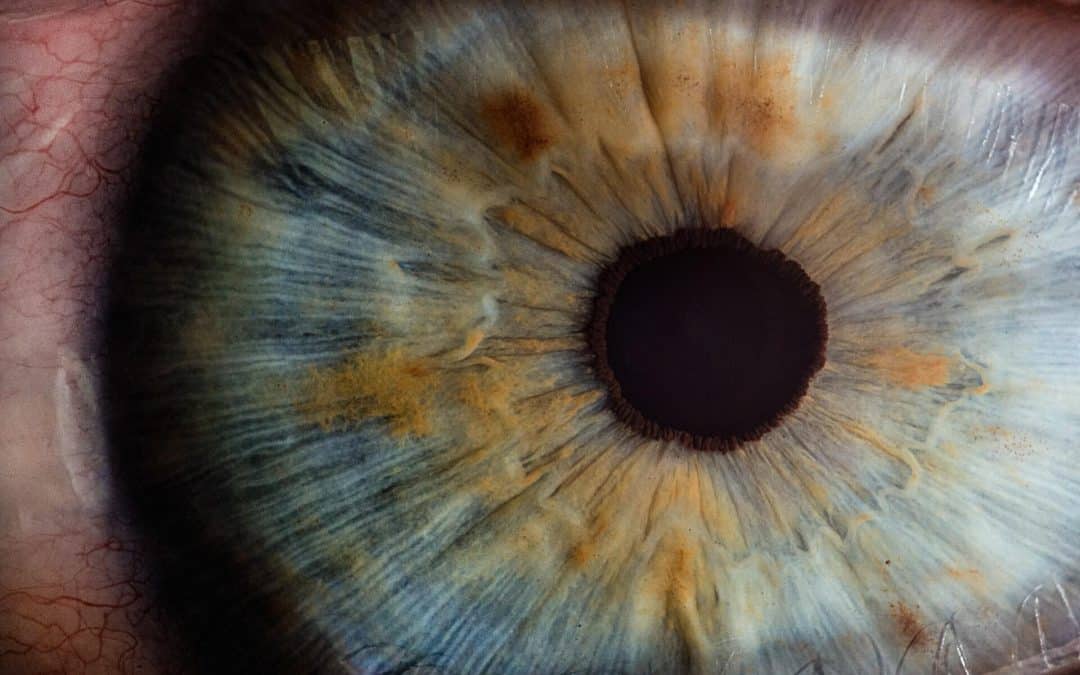 What Eye Diseases Affect the Cornea?